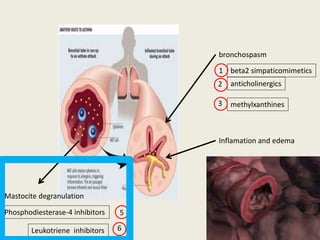 bronchospasm
anticholinergics
methylxanthines
beta2 simpaticomimetics
Inflamation and edema
glucocorticosteroids
Mastocite degranulation
Phosphodiesterase-4 inhibitors
1
2
3
4
5
Leukotriene inhibitors 6
 