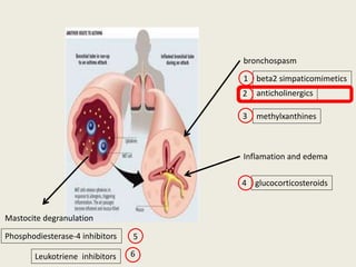 bronchospasm
anticholinergics
methylxanthines
beta2 simpaticomimetics
Inflamation and edema
glucocorticosteroids
Mastocite degranulation
Phosphodiesterase-4 inhibitors
1
2
3
4
5
Leukotriene inhibitors 6
 