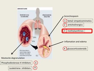 bronchospasm
anticholinergics
methylxanthines
beta2 simpaticomimetics
Inflamation and edema
glucocorticosteroids
Mastocite degranulation
Phosphodiesterase-4 inhibitors
1
2
3
4
5
Leukotriene inhibitors 6
 