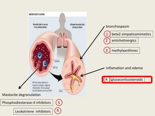 bronchospasm
anticholinergics
methylxanthines
beta2 simpaticomimetics
Inflamation and edema
glucocorticosteroids
Mastocite degranulation
Phosphodiesterase-4 inhibitors
1
2
3
4
5
Leukotriene inhibitors 6
 
