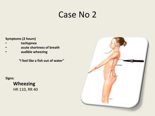 Case No 2
Symptoms (2 hours)
• tachypnea
• acute shortness of breath
• audible wheezing
“I feel like a fish out of water”
Signs:
Wheezing
HR 110, RR 40
 