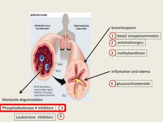 bronchospasm
anticholinergics
methylxanthines
beta2 simpaticomimetics
Inflamation and edema
glucocorticosteroids
Mastocite degranulation
Phosphodiesterase-4 inhibitors
1
2
3
4
5
Leukotriene inhibitors 6
 