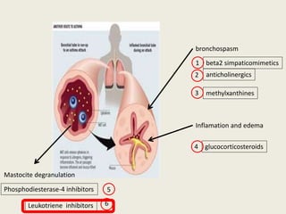 bronchospasm
anticholinergics
methylxanthines
beta2 simpaticomimetics
Inflamation and edema
glucocorticosteroids
Mastocite degranulation
Phosphodiesterase-4 inhibitors
1
2
3
4
5
Leukotriene inhibitors 6
 