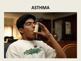 ASTHMA
 