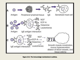 Figure 13-2. The immunologic mechanisms in asthma.
 