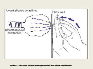 Figure 2-12. Percussion becomes more hyperresonant with alveolar hyperinflation.
 
