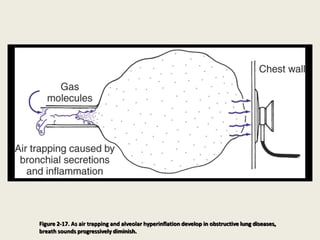 Figure 2-17. As air trapping and alveolar hyperinflation develop in obstructive lung diseases,
breath sounds progressively diminish.
 