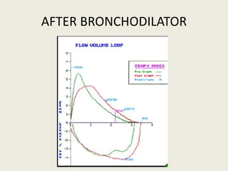 AFTER BRONCHODILATOR
 