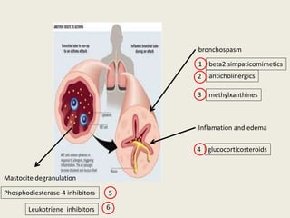 bronchospasm
anticholinergics
methylxanthines
beta2 simpaticomimetics
Inflamation and edema
glucocorticosteroids
Mastocite degranulation
Phosphodiesterase-4 inhibitors
1
2
3
4
5
Leukotriene inhibitors 6
 