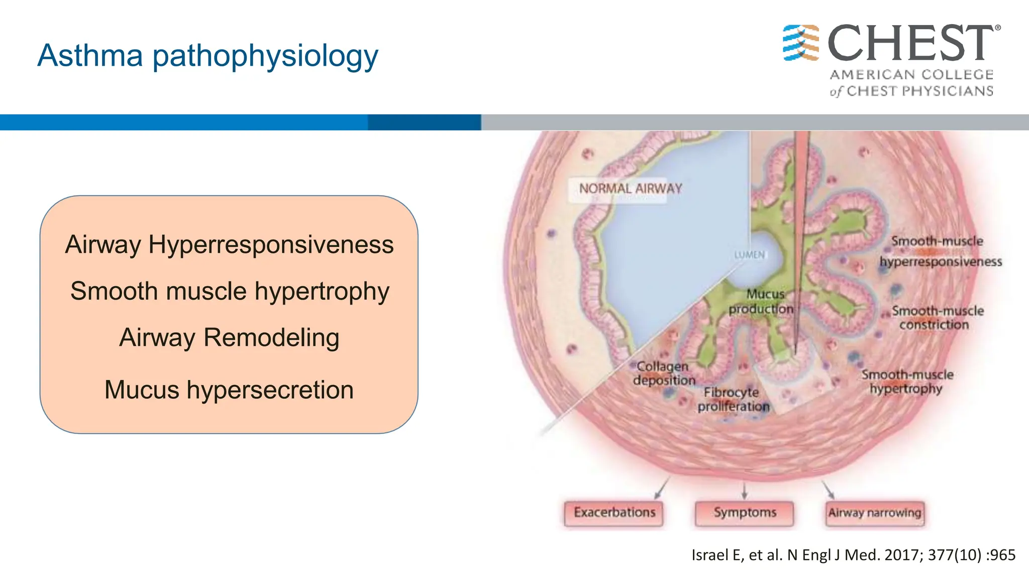 Asthma pathophysiology
Israel E, et al. N Engl J Med. 2017; 377(10) :965
Airway Hyperresponsiveness
Smooth muscle hypertrophy
Airway Remodeling
Mucus hypersecretion
 