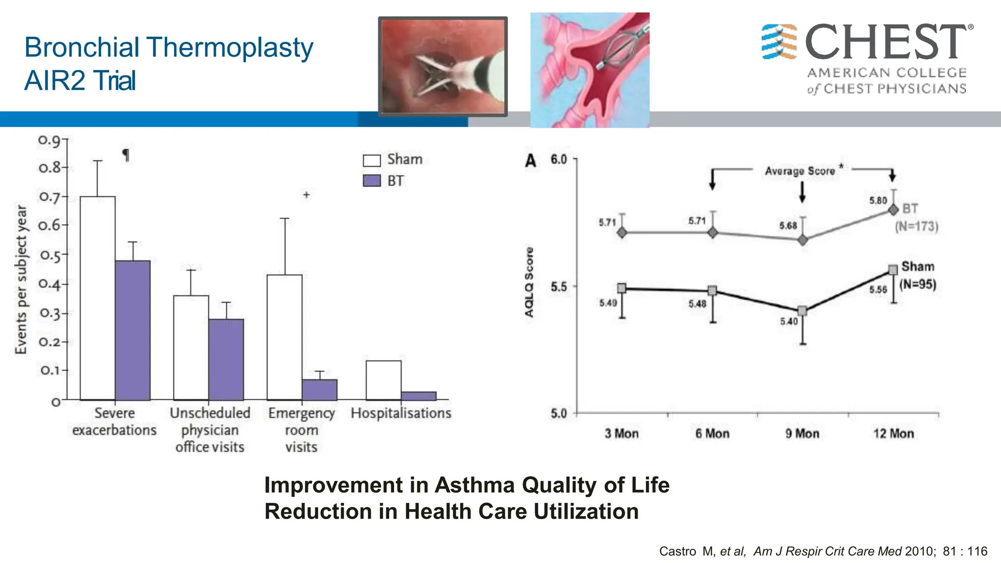 Bronchial Thermoplasty
AIR2 Trial
Improvement in Asthma Quality of Life
Reduction in Health Care Utilization
Castro M, et al, Am J Respir Crit Care Med 2010; 81 : 116
 