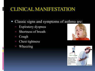 CLINICAL MANIFESTATION
 Classic signs and symptoms of asthma are:
 Expiratory dyspnea
 Shortness of breath
 Cough
 Chest tightness
 Wheezing
 