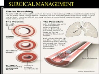 SURGICAL MANAGEMENT
 