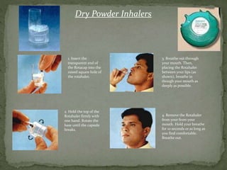 Rotacap Inhaler Machine ANTI-ASTHMATICS | PPTX