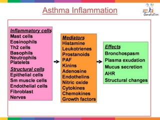 Asthma Inflammation
 