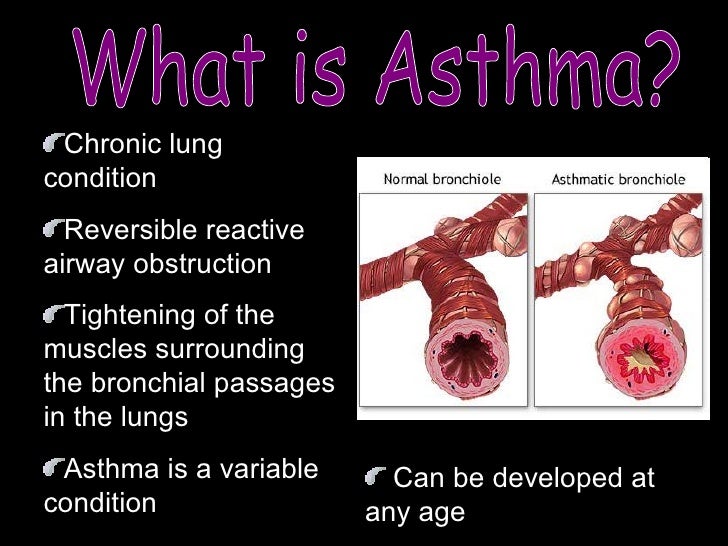Asthma Presentation