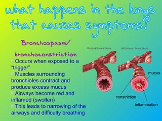 Bronchospasm/
bronchoconstriction
Occurs when exposed to a
“trigger”
Muscles surrounding
bronchioles contract and
produce excess mucus
Airways become red and
inflamed (swollen)
This leads to narrowing of the
airways and difficulty breathing
inflammation
constriction
mucus
 