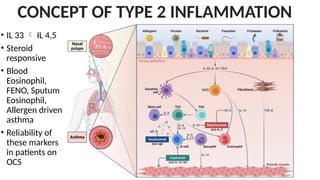 • IL 33  IL 4,5
• Steroid
responsive
• Blood
Eosinophil,
FENO, Sputum
Eosinophil,
Allergen driven
asthma
• Reliability of
these markers
in patients on
OCS
CONCEPT OF TYPE 2 INFLAMMATION
 