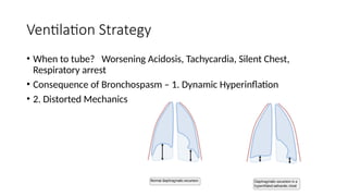 Ventilation Strategy
• When to tube? Worsening Acidosis, Tachycardia, Silent Chest,
Respiratory arrest
• Consequence of Bronchospasm – 1. Dynamic Hyperinflation
• 2. Distorted Mechanics
 