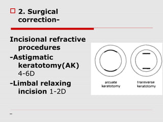  2. Surgical
correctionIncisional refractive
procedures
-Astigmatic
keratotomy(AK)
4-6D
-Limbal relaxing
incision 1-2D

 