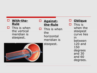  With-theRule
 This is when
the vertical
meridian is
steepest.

 Againstthe-Rule
 This is when
the
horizontal
meridian is
steepest.

 Oblique
 This is
when the
steepest
curve lies
in
between
120 and
150
degrees
and 30
and 60
degrees.

 
