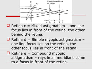  Retina c = Mixed astigmatism – one line
focus lies in front of the retina, the other
behind the retina.
 Retina d = Simple myopic astigmatism –
one line focus lies on the retina, the
other focus lies in front of the retina.
 Retina e = Compound myopic
astigmatism – rays in all meridians come
to a focus in front of the retina.

 