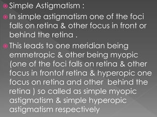  Simple Astigmatism :
 In simple astigmatism one of the foci
falls on retina & other focus in front or
behind the retina .
 This leads to one meridian being
emmetropic & other being myopic
(one of the foci falls on retina & other
focus in frontof retina & hyperopic one
focus on retina and other behind the
retina ) so called as simple myopic
astigmatism & simple hyperopic
astigmatism respectively
 