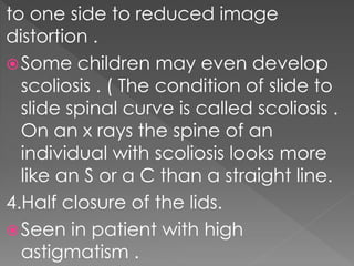 to one side to reduced image
distortion .
Some children may even develop
scoliosis . ( The condition of slide to
slide spinal curve is called scoliosis .
On an x rays the spine of an
individual with scoliosis looks more
like an S or a C than a straight line.
4.Half closure of the lids.
Seen in patient with high
astigmatism .
 