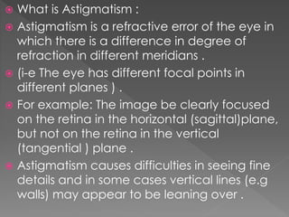  What is Astigmatism :
 Astigmatism is a refractive error of the eye in
which there is a difference in degree of
refraction in different meridians .
 (i-e The eye has different focal points in
different planes ) .
 For example: The image be clearly focused
on the retina in the horizontal (sagittal)plane,
but not on the retina in the vertical
(tangential ) plane .
 Astigmatism causes difficulties in seeing fine
details and in some cases vertical lines (e.g
walls) may appear to be leaning over .
 