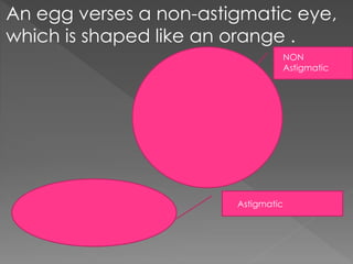 An egg verses a non-astigmatic eye,
which is shaped like an orange .
NON
Astigmatic
Astigmatic
 