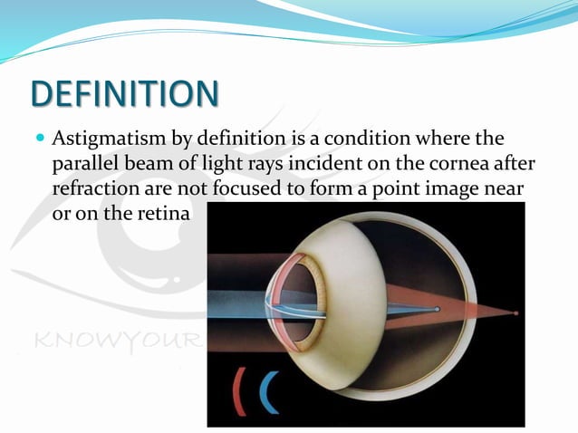 Astigmatism | PPTX | Eye and Vision Conditions | Diseases and Conditions