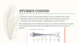 Conoid Ridge Astigmatism | PPTX