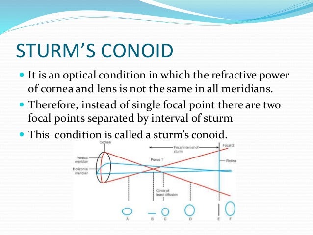 Sturm S Conoid