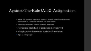 Against-The-Rule (ATR) Astigmatism
• When the greatest refractive power is within 030 of the horizontal
meridian (i.e., between 030 and 150 meridians)
• Minus cylinder axis around vertical meridian
• Horizontal meridian of cornea is more curved
• Myopic power is more in horizontal meridian
 Eg :- -3.0D cyl x 90˚
 