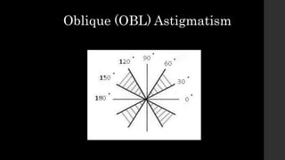 Oblique (OBL) Astigmatism
 