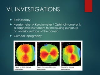 VI. INVESTIGATIONS
 Retinoscopy
 Keratometry- A Keratometer / Ophthalmometer is
a diagnostic instrument for measuring curvature
of anterior surface of the cornea
 Corneal topography
 