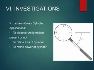 VI. INVESTIGATIONS
 Jackson Cross Cylinder
Applications:
• To discover Astigmatism
present or not
• To refine axis of cylinder
• To refine power of cylinder
 