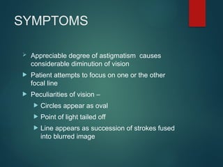 SYMPTOMS
 Appreciable degree of astigmatism causes
considerable diminution of vision
 Patient attempts to focus on one or the other
focal line
 Peculiarities of vision –
 Circles appear as oval
 Point of light tailed off
 Line appears as succession of strokes fused
into blurred image
 
