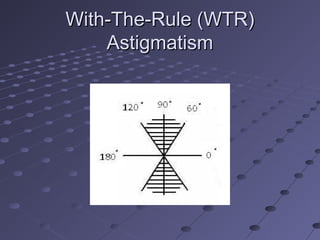 With-The-Rule (WTR)With-The-Rule (WTR)
AstigmatismAstigmatism
 
