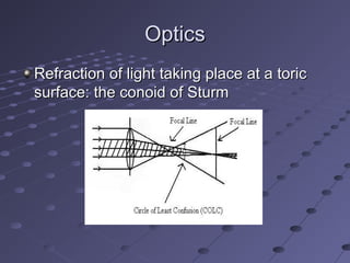 OpticsOptics
Refraction of light taking place at a toricRefraction of light taking place at a toric
surface: the conoid of Sturmsurface: the conoid of Sturm
 