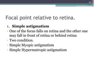 13
Focal point relative to retina.
1. Simple astigmatism
- One of the focus falls on retina and the other one
may fall in front of retina or behind retina
- Two condition.
- Simple Myopic astigmatism
- Simple Hypermatropic astigmatism
 