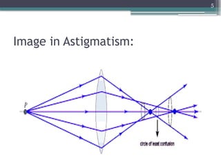 5
Image in Astigmatism:
 