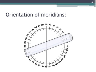 9
Orientation of meridians:
 