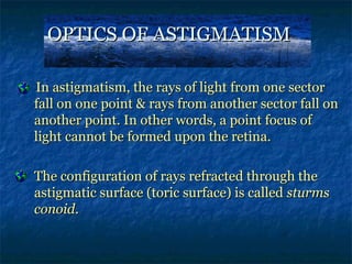 Astigmatism By Sumayya Naseem | PPS