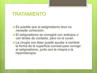 Astigmatismo por Tatiana Chamorro