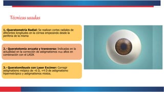 Técnicas usadas
1.-Queratometría Radial: Se realizan cortes radiales de
diferentes longitudes en la córnea empezando desde la
periferia de la misma
2.- Queratotomía arcuata y transversa: Indicadas en la
actualidad en la corrección de astigmatismos muy altos en
combinación con el LASIK
3.- Queratomileusis con Laser Excimer: Corregir
astigmatismo miópico de –6 D, +4 D de astigmatismo
hipermetrópico y astigmatismos mixtos.
 