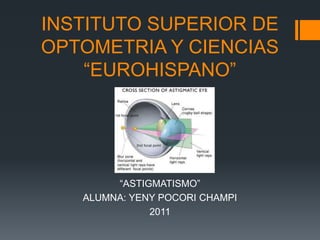 INSTITUTO SUPERIOR DE
OPTOMETRIA Y CIENCIAS
    “EUROHISPANO”




        “ASTIGMATISMO”
   ALUMNA: YENY POCORI CHAMPI
              2011
 
