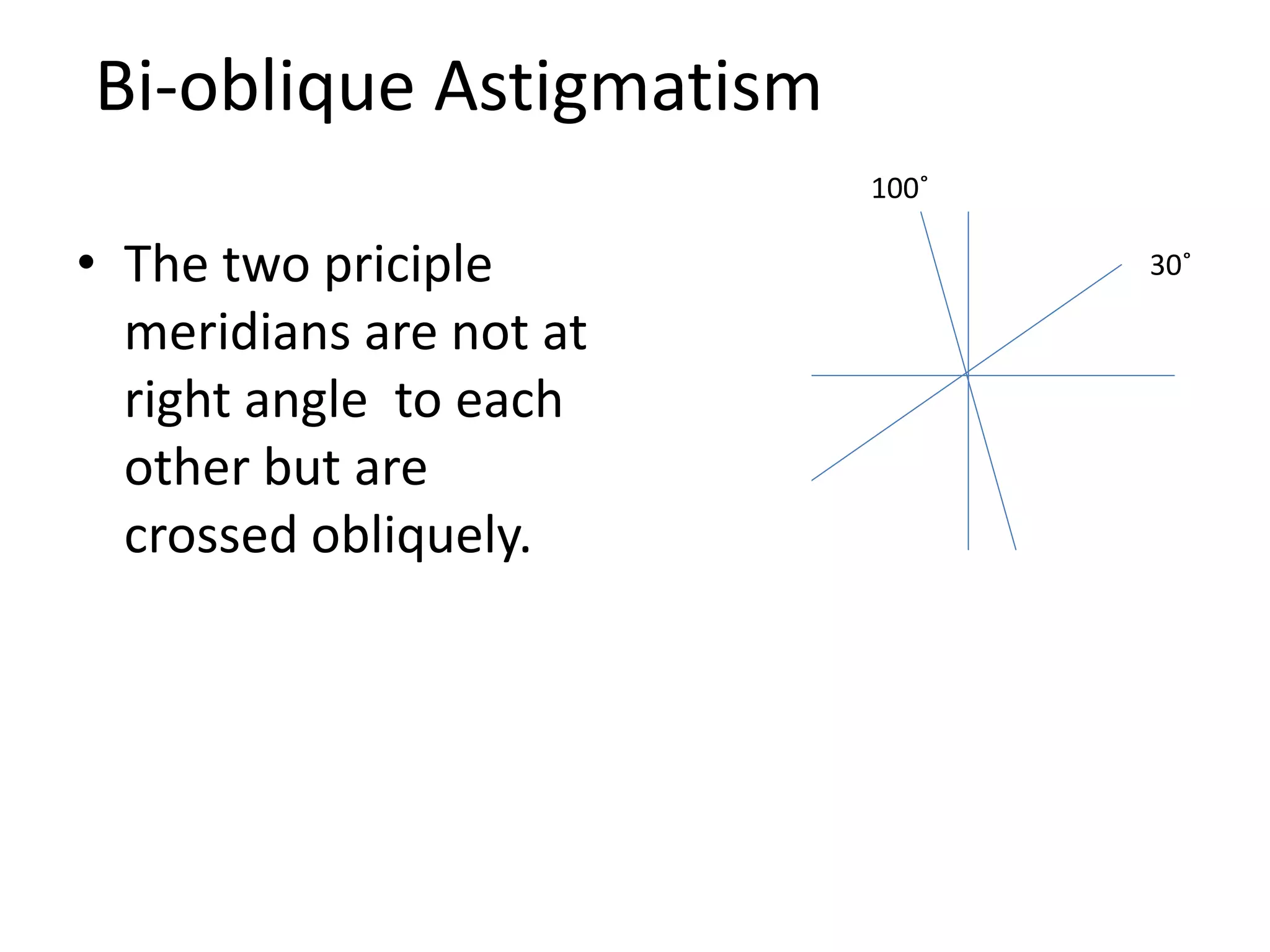 Bi-oblique Astigmatism
• The two priciple
meridians are not at
right angle to each
other but are
crossed obliquely.
30˚
100˚
 