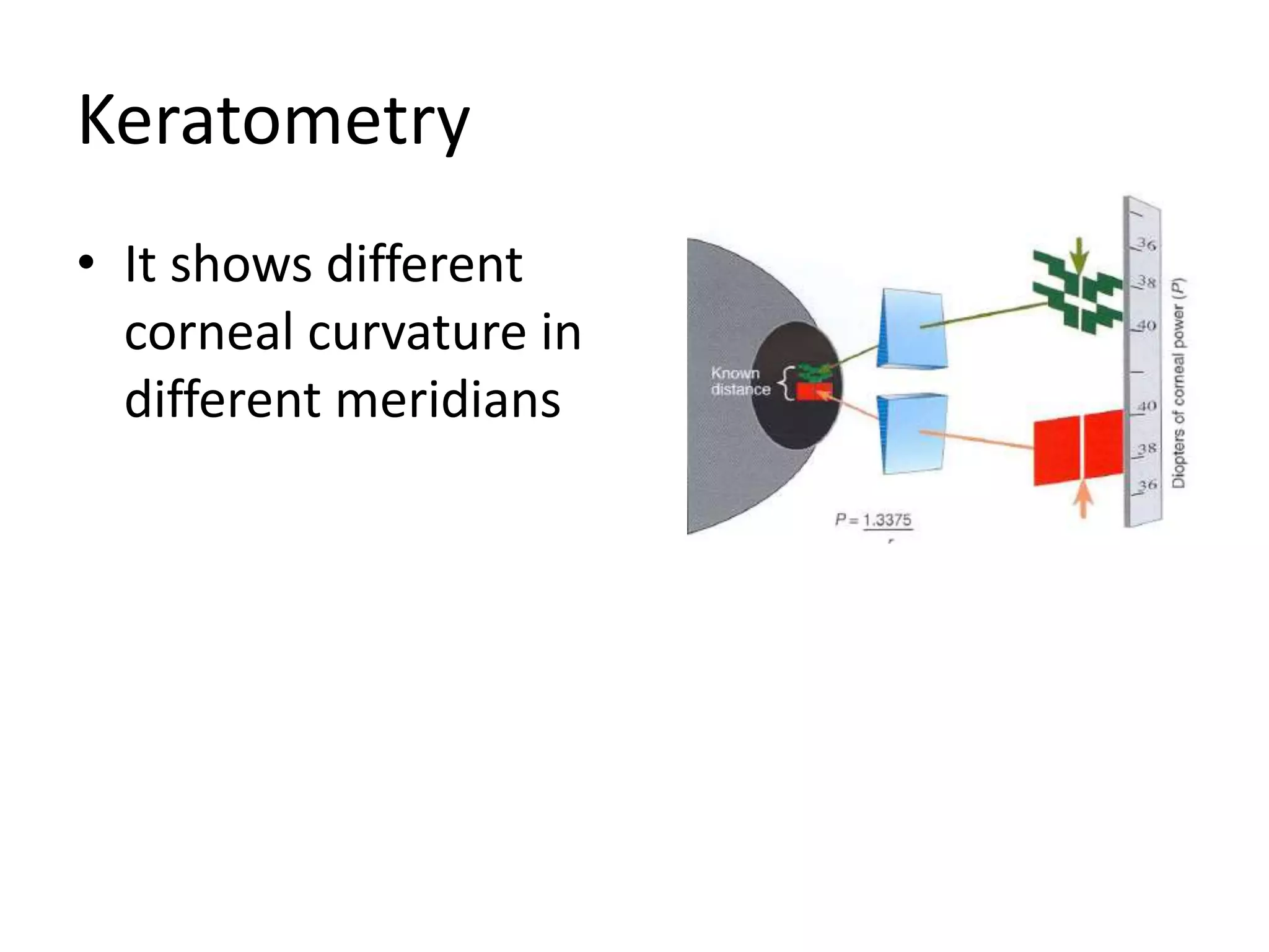 Keratometry
• It shows different
corneal curvature in
different meridians
 