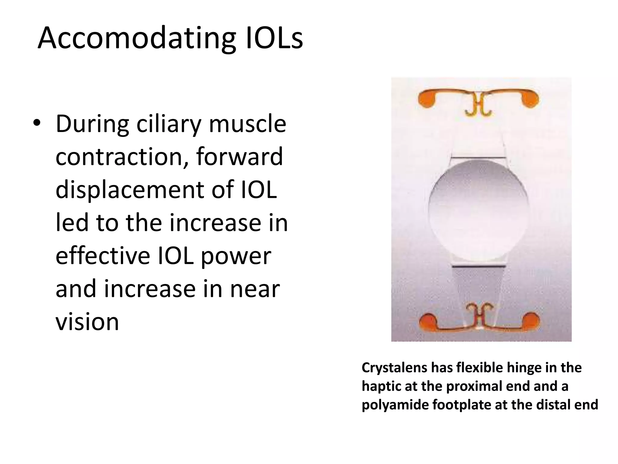 Accomodating IOLs
• During ciliary muscle
contraction, forward
displacement of IOL
led to the increase in
effective IOL power
and increase in near
vision
Crystalens has flexible hinge in the
haptic at the proximal end and a
polyamide footplate at the distal end
 